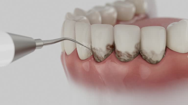 Trusted Teeth Cleaning And Checkup service in Guthrie Center, IA - Dentist Open Now